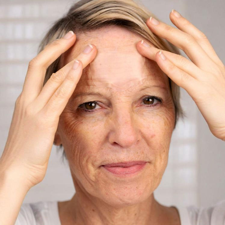 Microneedle Forehead Patches